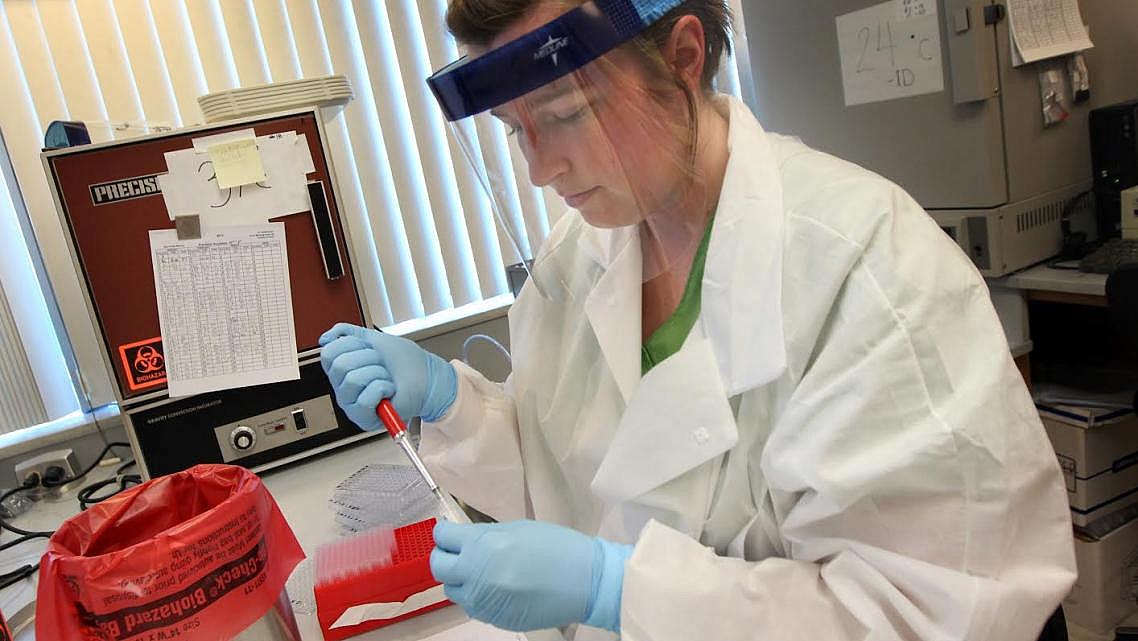 Lab Assistant Erin Scott with the Kern County Public Health Services Department places valley fever patient samples into test trays. (Casey Christie/The Bakersfield Californian)