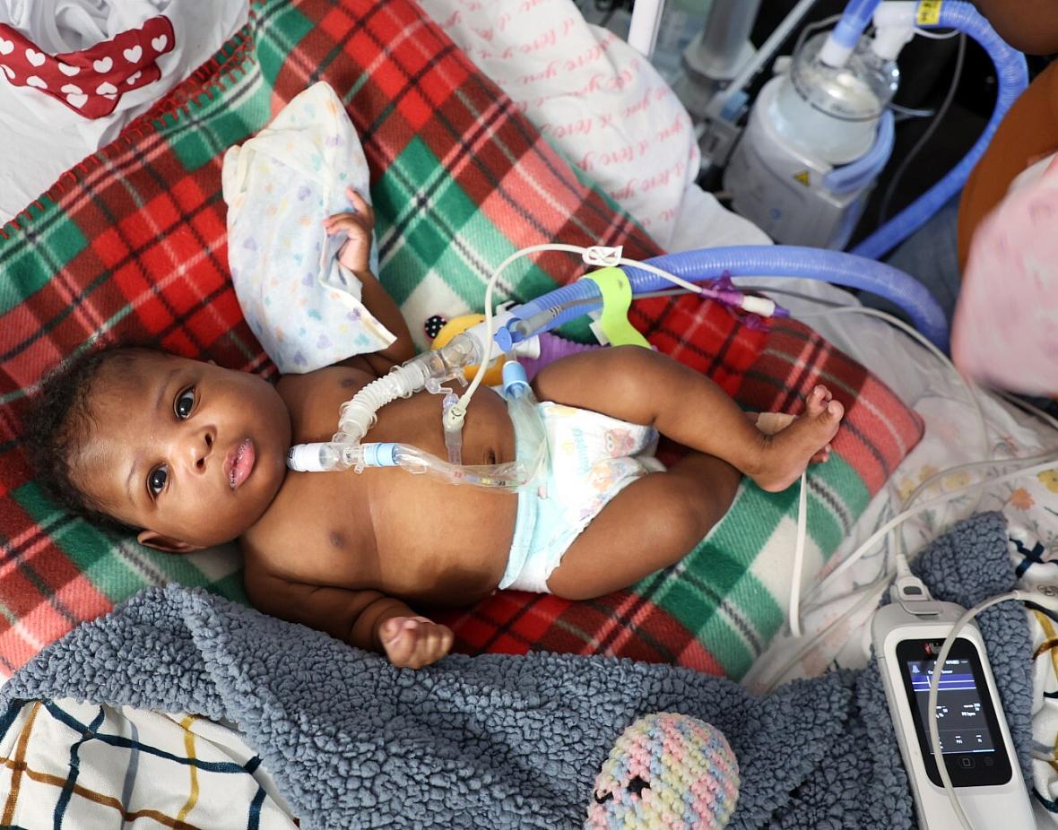 Image of a baby in a crib hooked up to life-saving machines