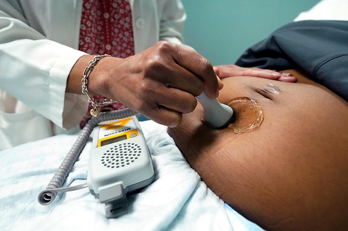 A doctor uses a hand-held Doppler probe on a pregnant woman to measure the heartbeat of the fetus. A review of data has revealed that, over time, Black rural counties in Georgia are being disinvested in, while more labor and delivery units are opening in majority white rural counties.