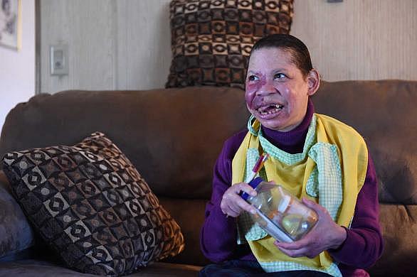 Terral Senior (right), 57, laughs as her mother, Theresa Senior, answers questions at their home in Hephzibah. Terral Senior is a patient at Gracewood wing of East Central Hospital. JON-MICHAEL SULLIVAN/STAFF