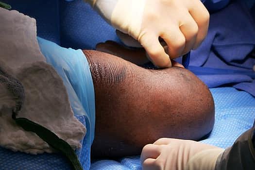 Vascular surgeon Sammy Siada, DO, prepares for an amputation revision procedure.