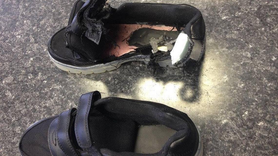 Keyon Felder’s right shoe bears witness to his near-deadly encounter with lightning.