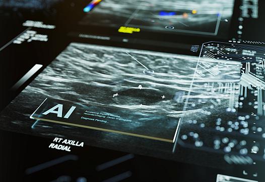 AI radiology image.