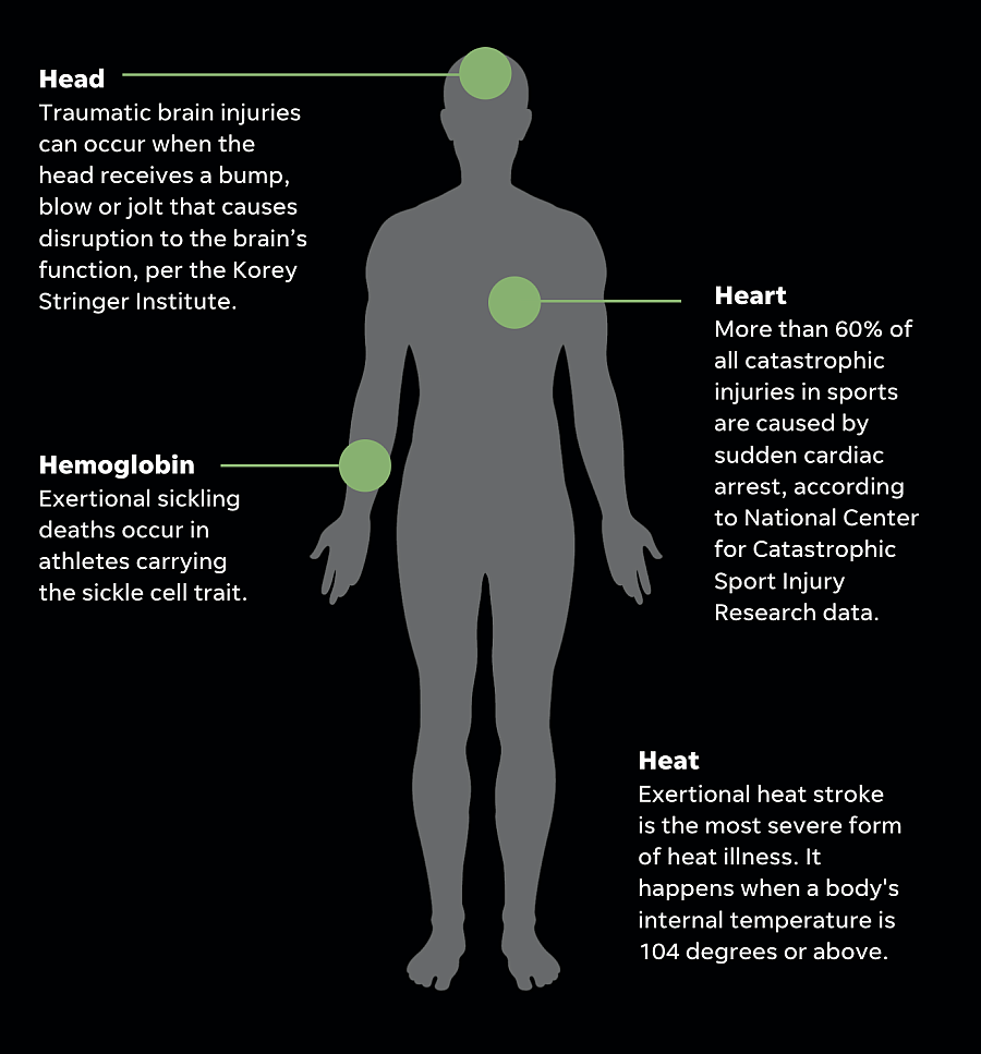 Illustration of human body showing 4 conditions which causes death in atheletes