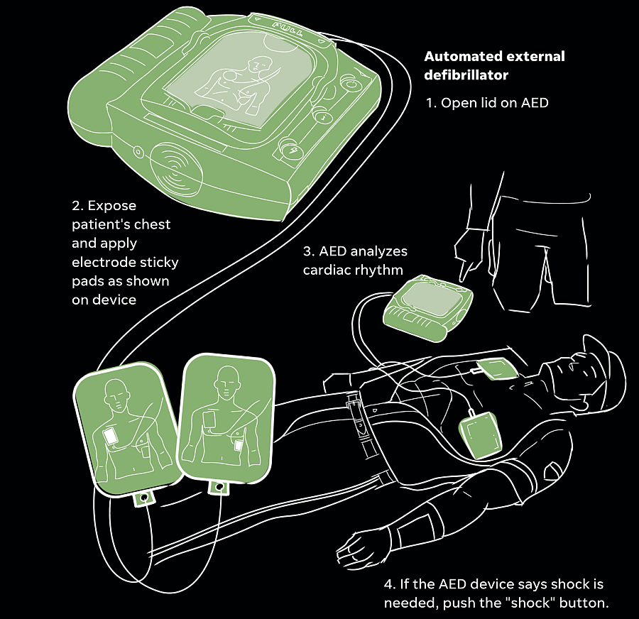 Illustration demonstrating steps to use defibrillator.