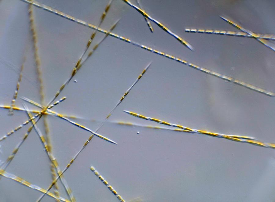 Pseudo-nitzschia, a type of algae that produces a toxin called domoic acid
