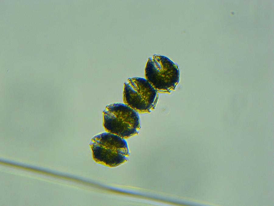 Alexandrium cells collected from Kachemak Bay 