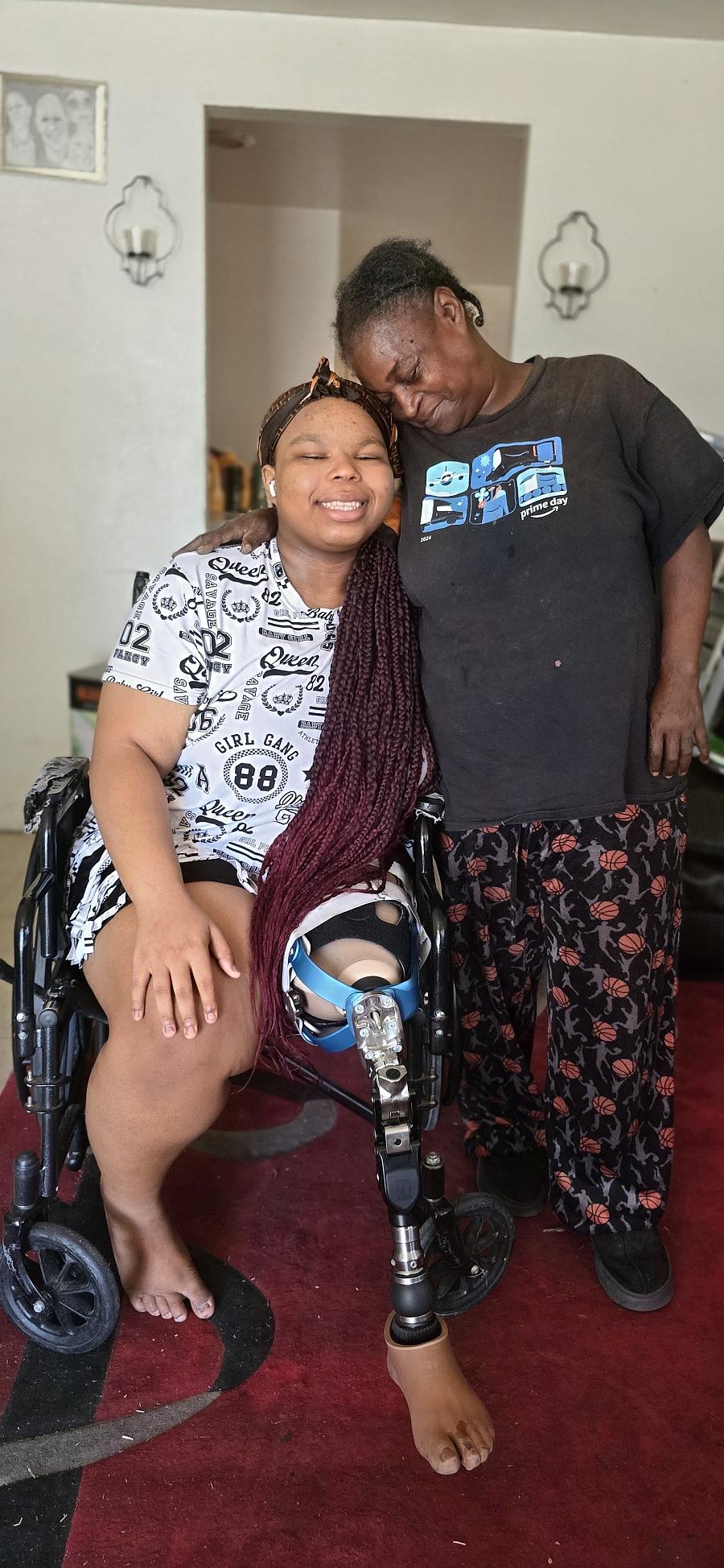 A Black grandmother embraces her granddaughter Sarabhi who wears a prosthetic leg.