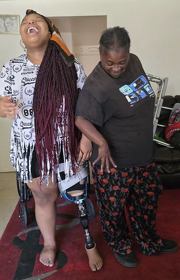 A young Black woman, wearing a prosthetic leg, and her grandmother strike a pose in their Kern County living room.