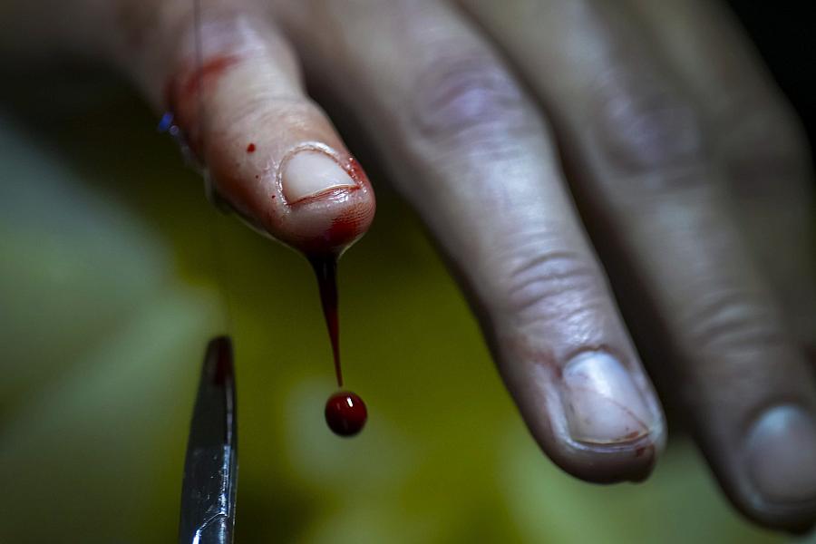 Image of a blood drop dripping from a finger