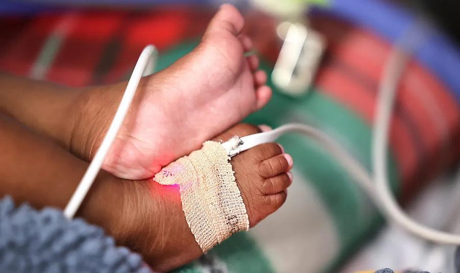 Baby's feet hooked up to medical device