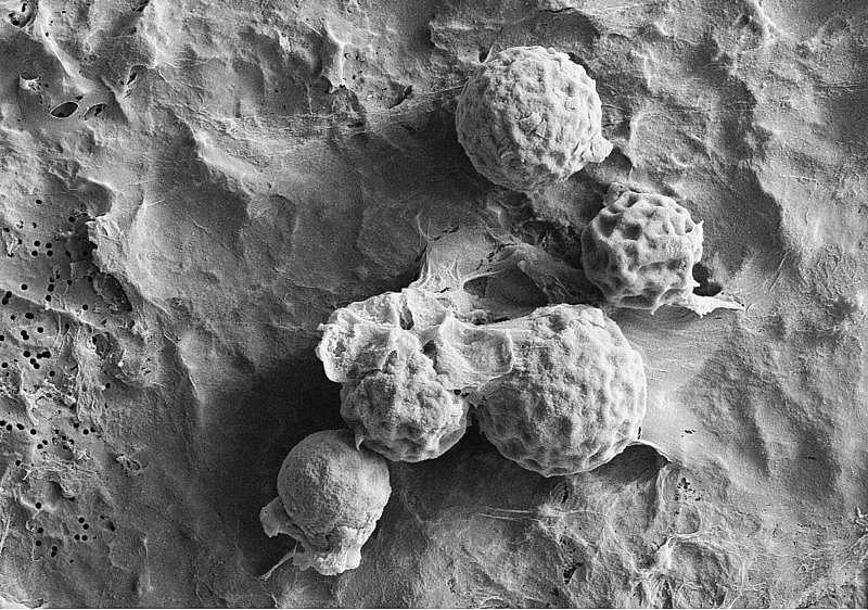 A scanning electron microscope image of the spherules of Coccidioides posadasii, one of the species of fungus that causes Valley Fever. The species is named after Argentinian physician Alejandro Posadas who was the first to identify the disease in a 33-year-old cavalryman in San Juan in 1892. Credit: Bridget Barker