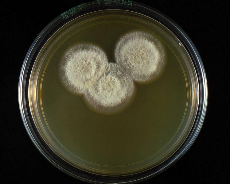 Plates of Coccidioides immitis. Credit: CDC/Dr. Libero Ajello/Public Domain