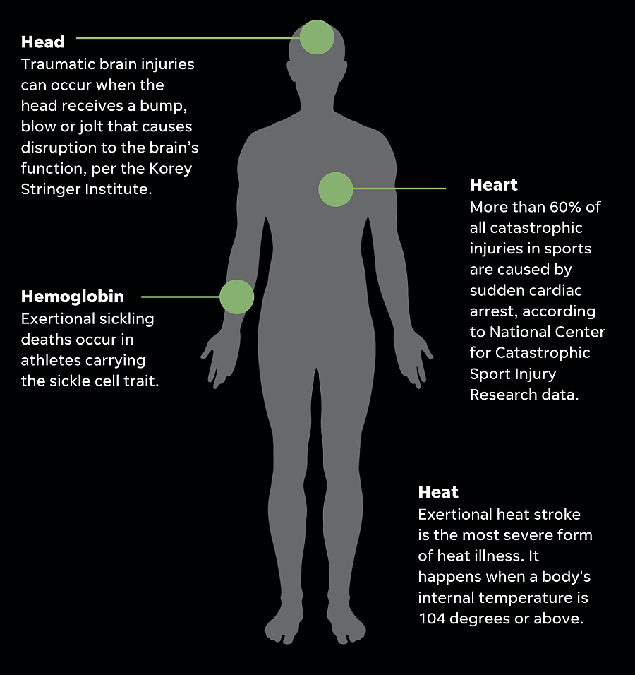 Illustration of human body showing 4 conditions which causes death in atheletes