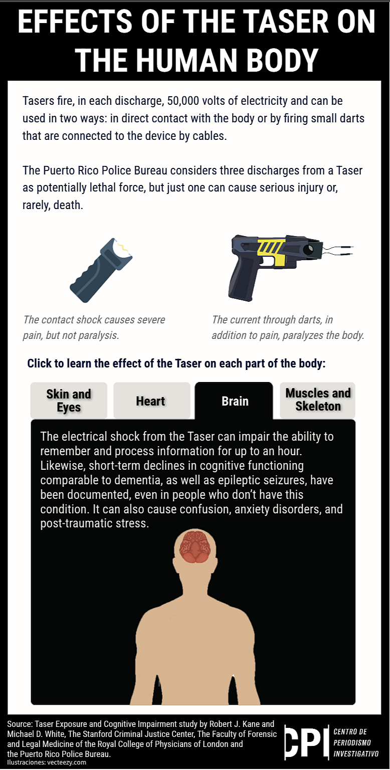 Illustration showing effects of taser on brain