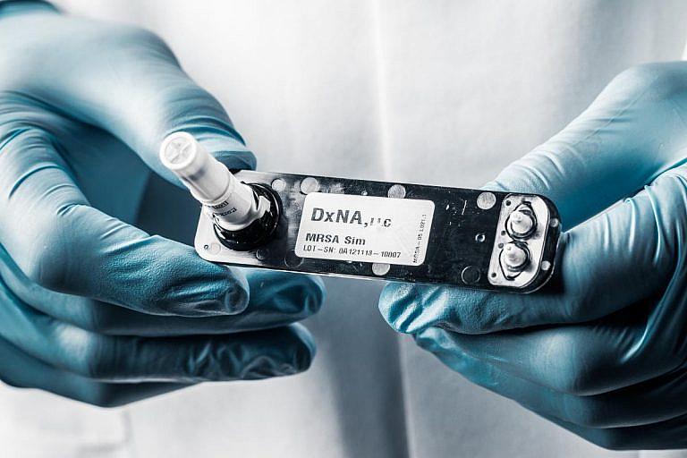 A new rapid-detection test for valley fever developed by DxNA LLC. directly identifies the cocci fungus in the body for the first time. Traditional serological tests identify antibodies produced by the immune system to fight the disease. CREDIT: DxNA LLC
