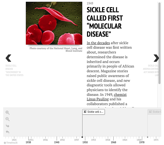 Timeline of Sickle Cell Disease