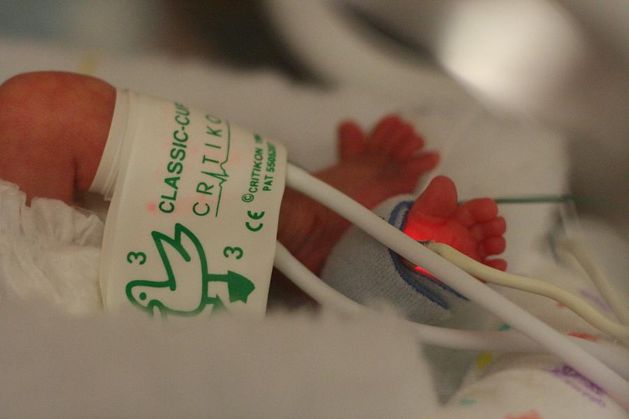 An infant in the NICU.