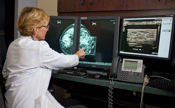 Doctor examines digital mammogram, pointing to a possible cancer. Credit: National Cancer Institute