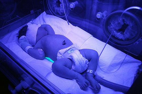 Infant in NICU