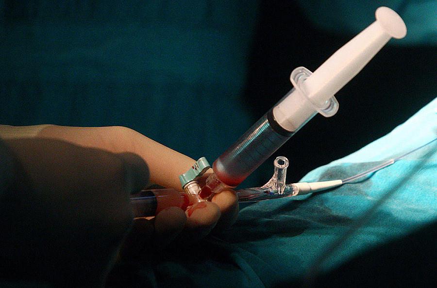 Surgeons perform a stem cell operation on a patient. 