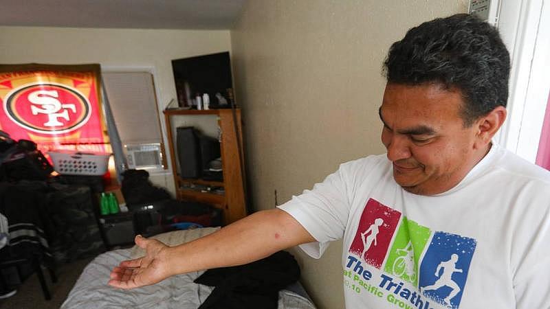 Francisco Ramirez shows a welt on his arm from a bedbug bite. Ramirez a three-year resident of Grand View Apartments, said black mold, bedbug bites, roaches and mice were common at the Paso Robles complex. David Middlecamp DMIDDLECAMP@THETRIBUNENEWS.COM