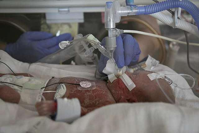 Keenen was born on July 23, roughly three months early. Photo: Lisa Krantz /Staff photographer