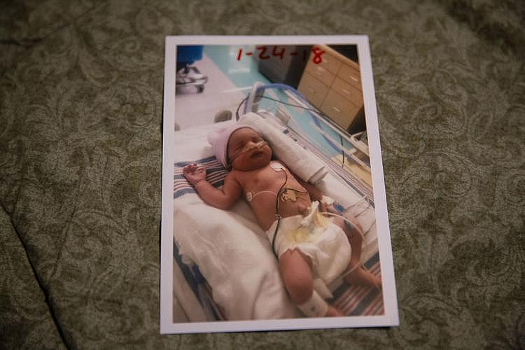 Jasmin is shown in the hospital after she was born prematurely. [Photo by Angela Piazza]