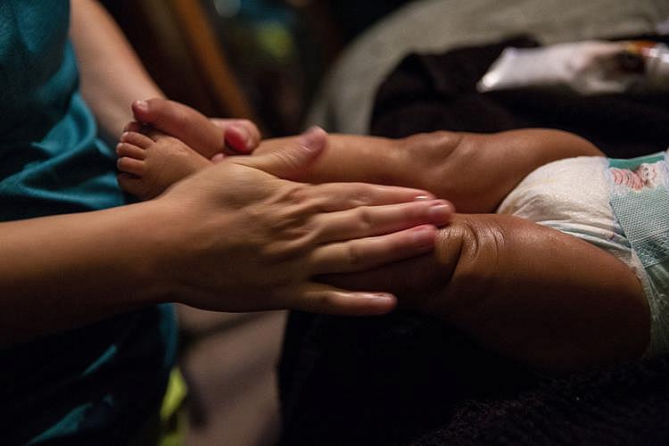 Angelica rubs a prescription synthetic steroid cream on Jasmin's body to ease the dry discolored spots on her skin. [Photo by Angela Piazza]