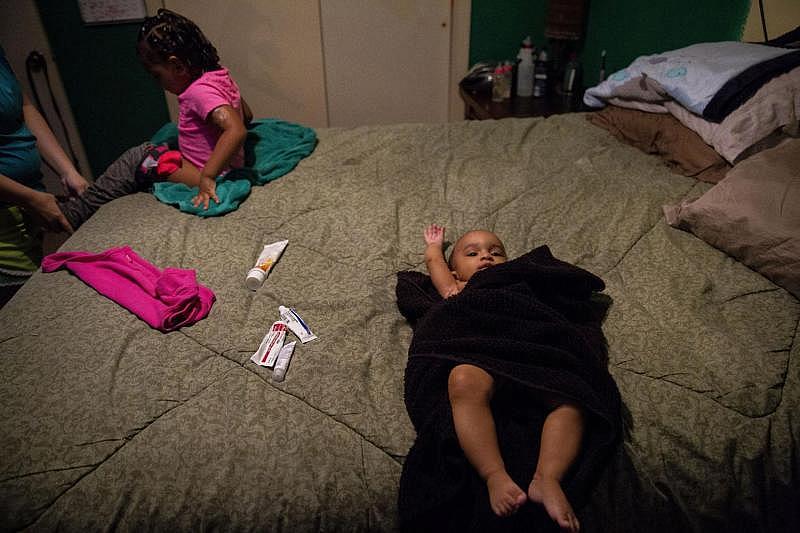 Various prescription and non-prescription ointments for Tiana, left, and Jasmin lie between them on the master bedroom bed after the girls' bath. Angelica gets the 2-year-old dressed while the 6-month-old waits patiently. [Photo by Angela Piazza]