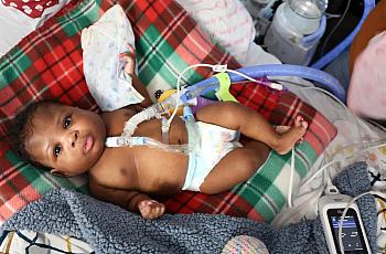 baby hooked up to a heart monitor and other machines.