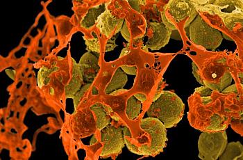 MRSA bacteria.