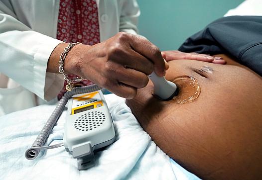 A doctor uses a hand-held Doppler probe on a pregnant woman to measure the heartbeat of the fetus. A review of data has revealed that, over time, Black rural counties in Georgia are being disinvested in, while more labor and delivery units are opening in majority white rural counties.