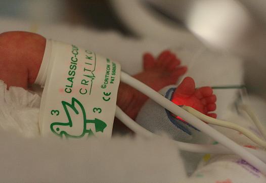 An infant in the NICU.