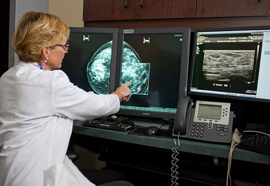 Doctor examines digital mammogram, pointing to a possible cancer. Credit: National Cancer Institute