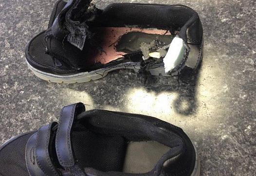 Keyon Felder’s right shoe bears witness to his near-deadly encounter with lightning.