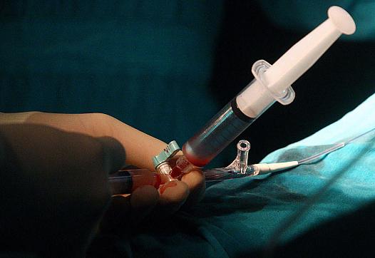 Surgeons perform a stem cell operation on a patient. 