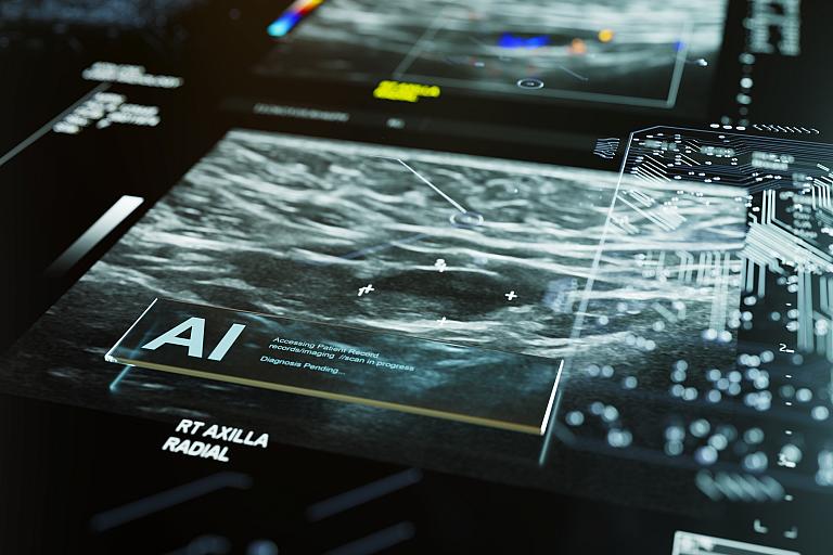 AI radiology image.