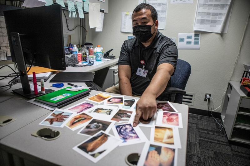 Hou Vang shows the postcards issued by the U.S. Centers for Disease Control with pictures of syphilis symptoms he carries to show patients what syphilis symptoms can look like on June 9, 2022.