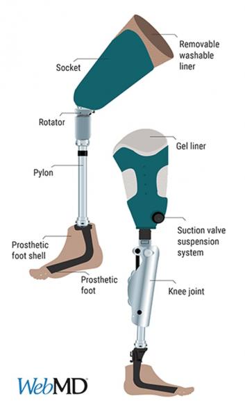 Examples of prosthetic lower-limbs.