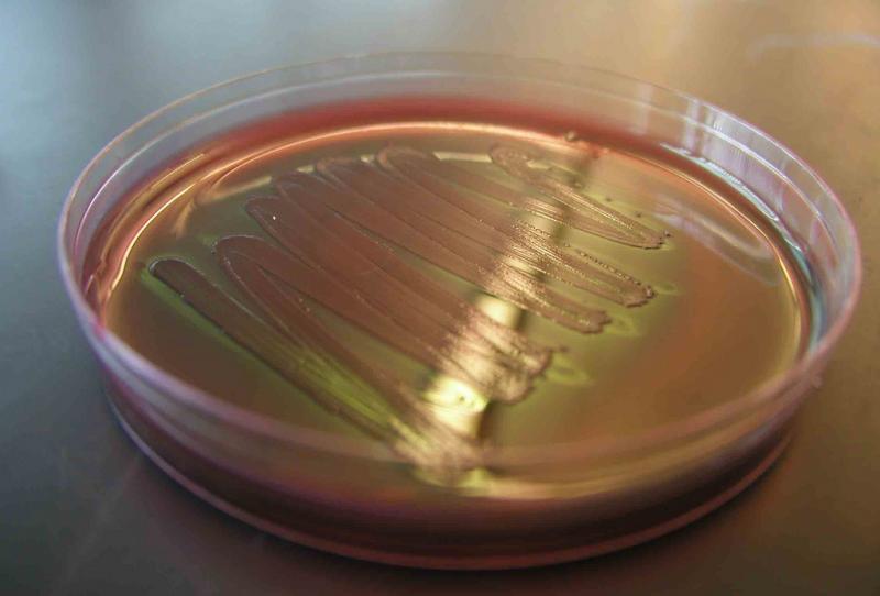 E. coli, food safety, FDA, reporting on health, health journalism